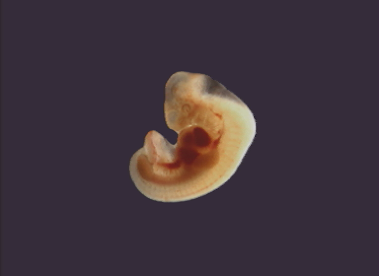 cdi/achild png snap