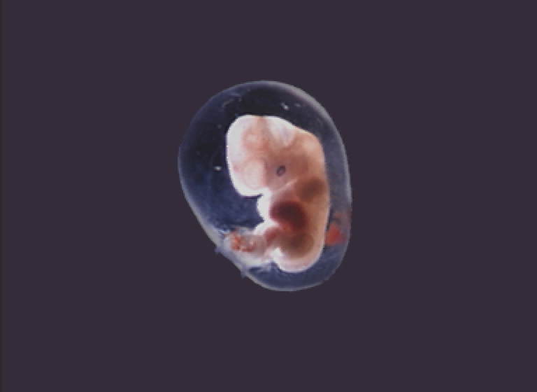 cdi/achildo png snap